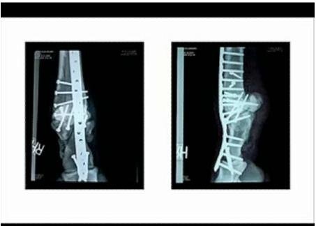 Rentgeny Barbarovy pravé zadní nohy