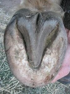 nahromaděná mrtvá rohovina chodidla