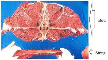 břišní a hřbetní svaly