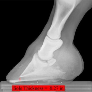 Tenké chodidlo Tenké chodidlo