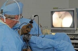 Artroskopický zákrok